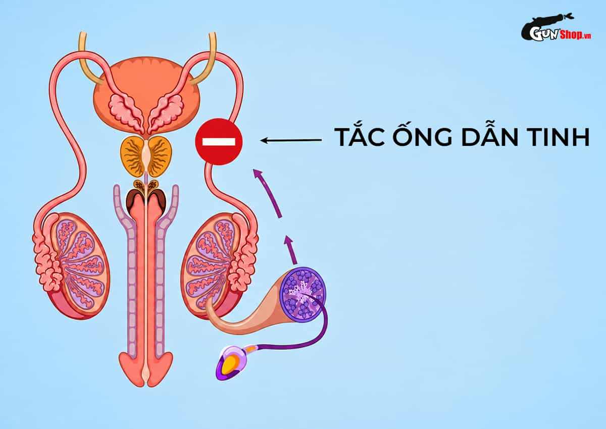 Xuất tinh ra máu là gì? Nguyên nhân và dấu hiệu cần đi viện gấp!