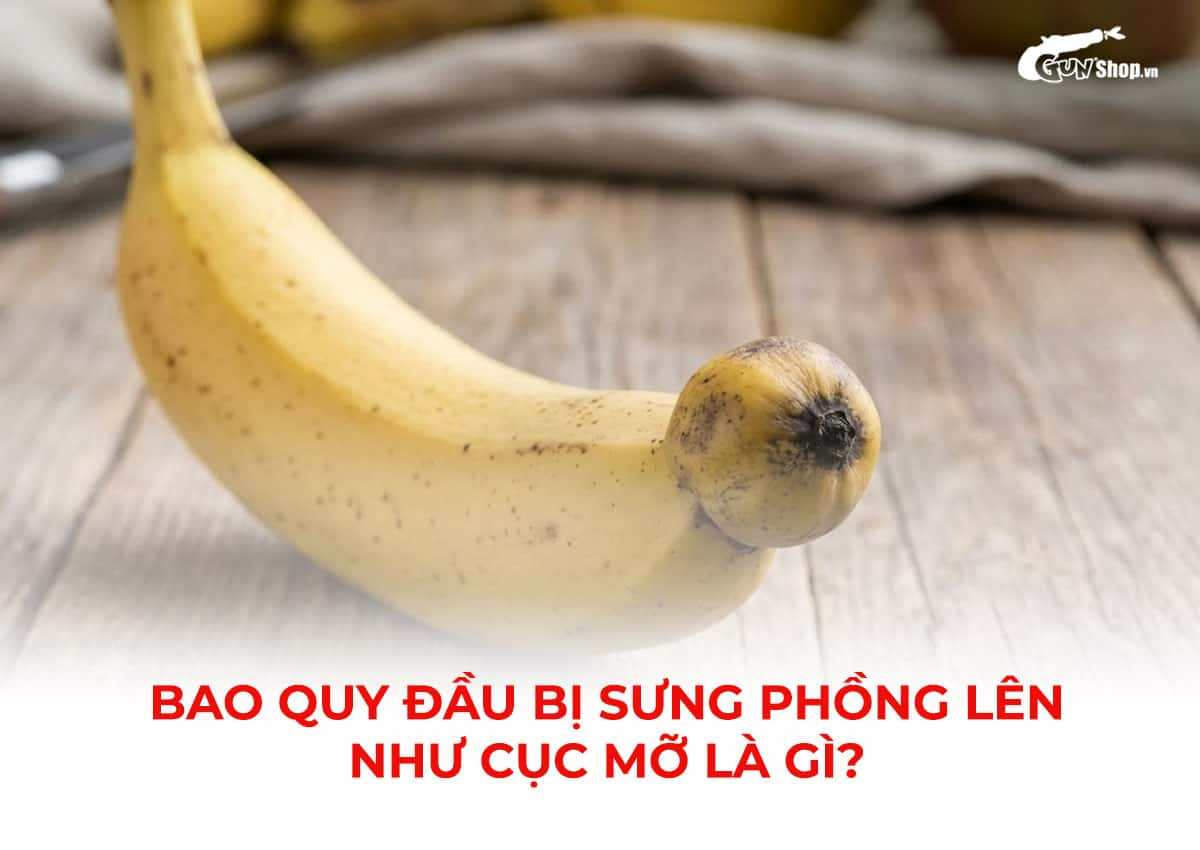 Bao quy đầu bị sưng phồng lên như cục mỡ