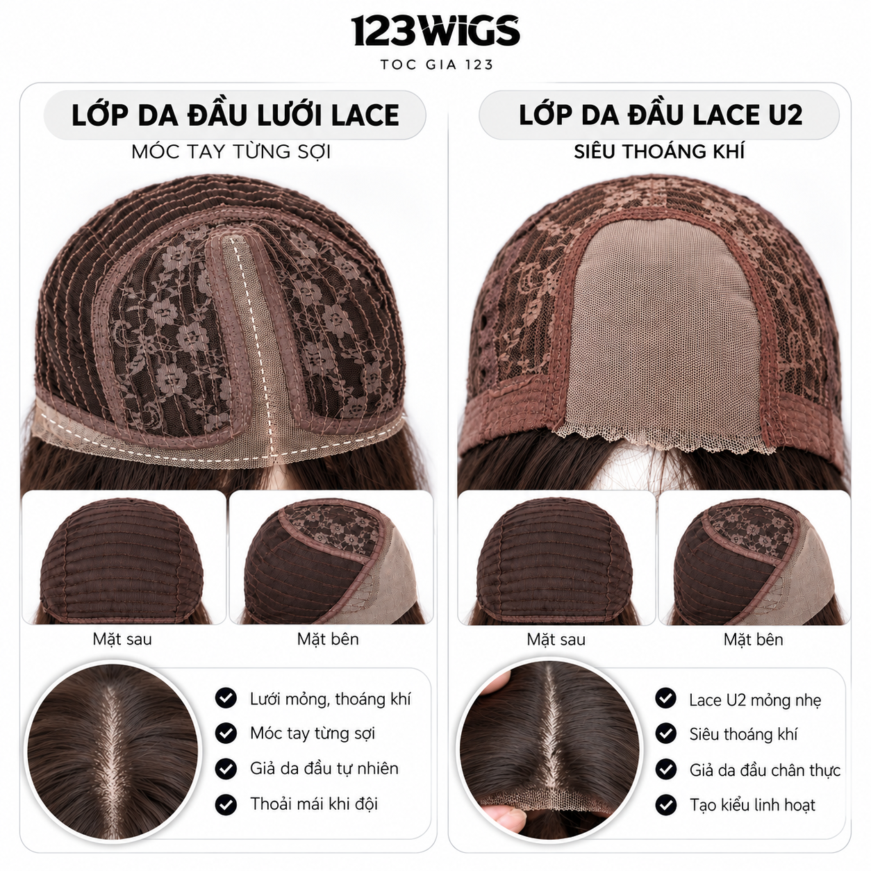 Minh họa cấu tạo lưới Lace và Lace U2