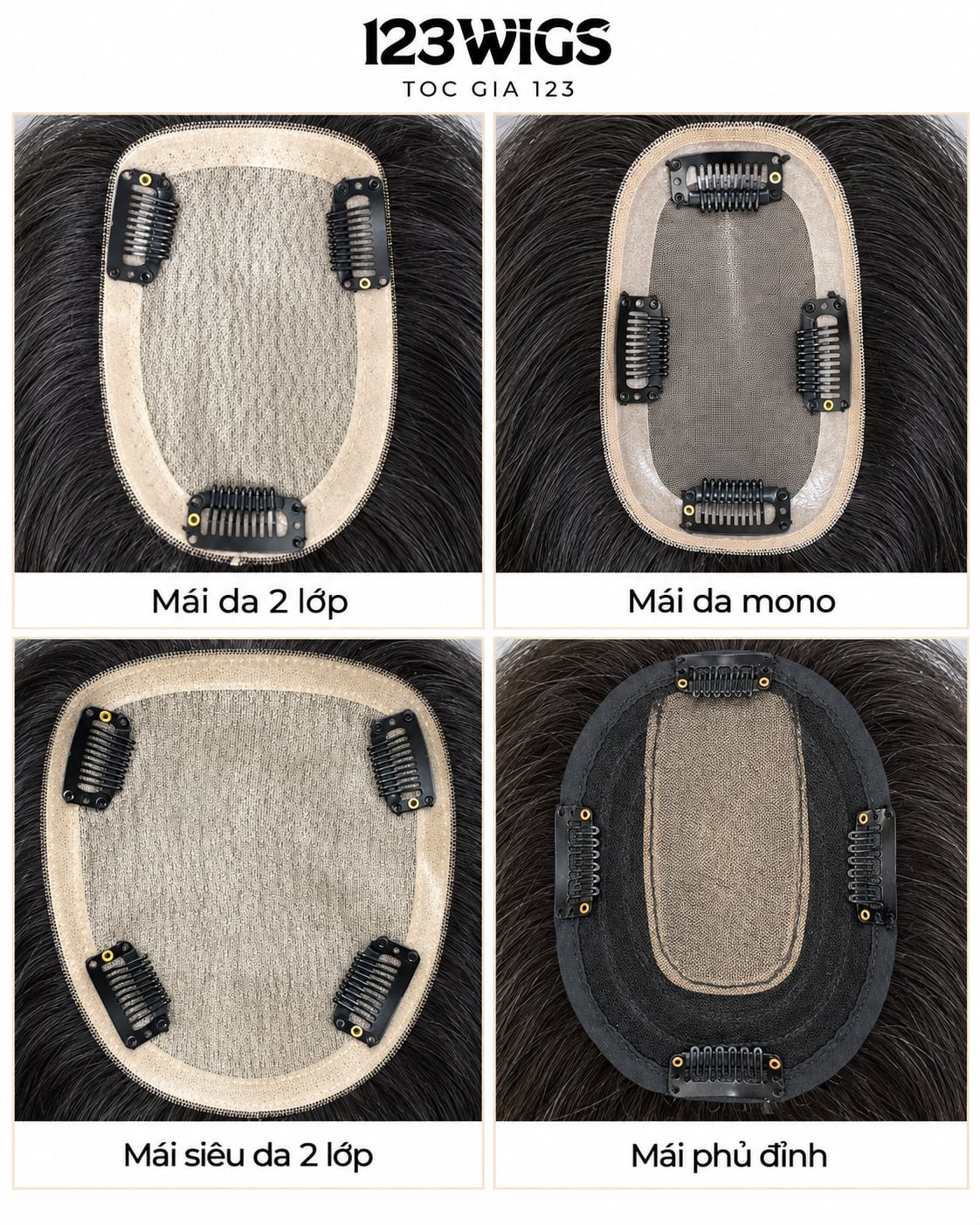 Các loại mái phủ đỉnh