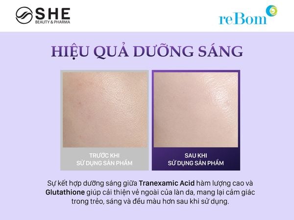 gia công serum dưỡng trắng da
