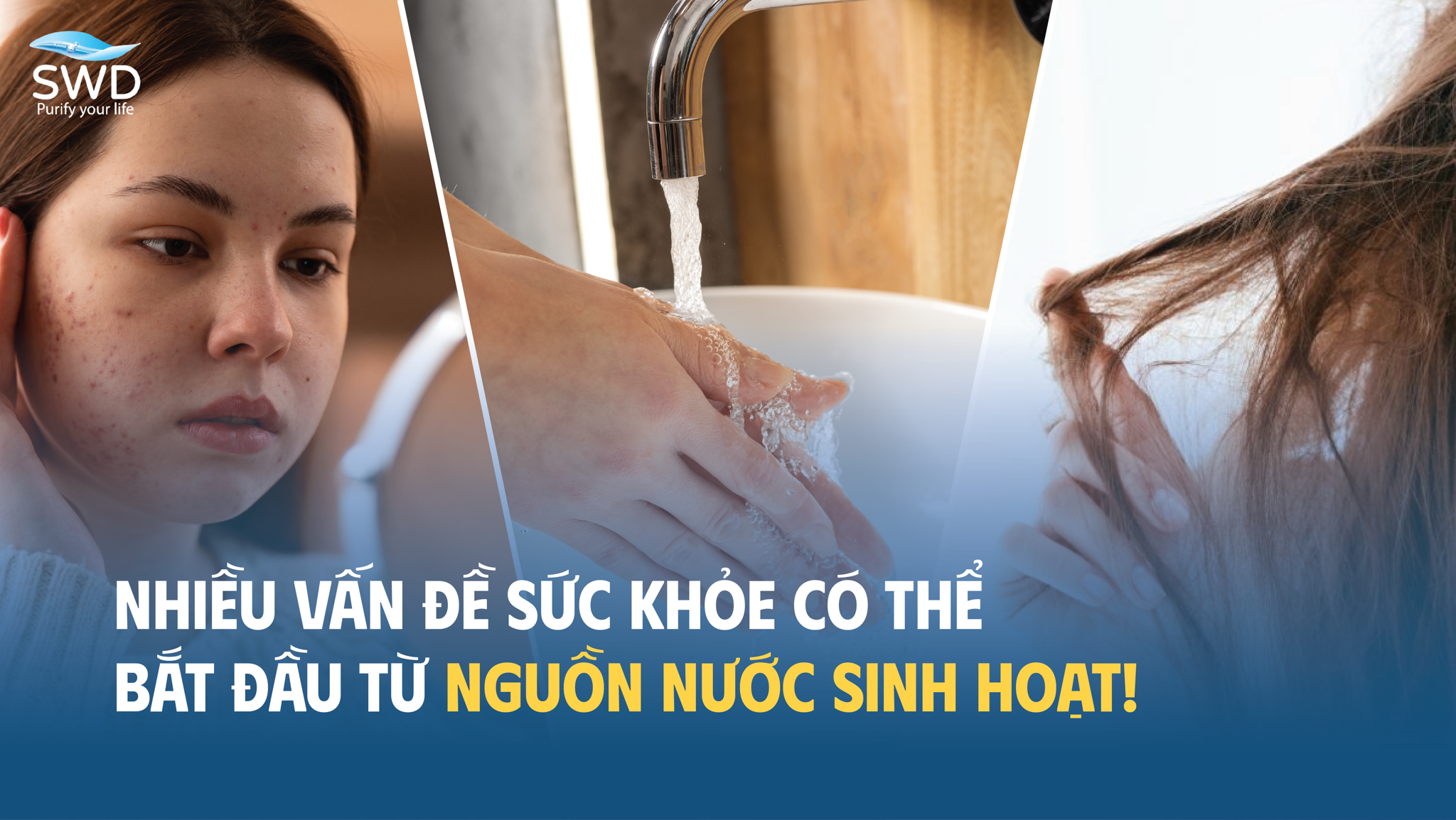 NHIỀU VẤN ĐỀ SỨC KHỎE CÓ THỂ BẮT ĐẦU TỪ NGUỒN NƯỚC SINH HOẠT!