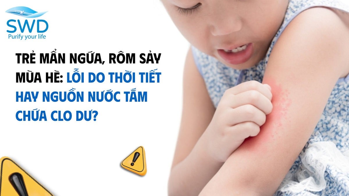 Trẻ mẩn ngứa, rôm sảy mùa hè: Lỗi do thời tiết hay nguồn nước tắm chứa Clo dư?