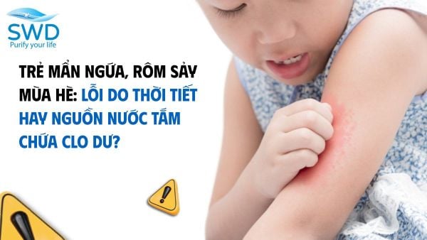 Trẻ mẩn ngứa, rôm sảy mùa hè: Lỗi do thời tiết hay nguồn nước tắm chứa Clo dư?