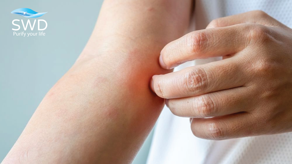 Cư dân chung cư thường lầm tưởng nước máy tại vòi luôn an toàn tuyệt đối. Khám phá sự thật về rủi ro nhiễm khuẩn từ bể chứa ngầm và giải pháp lọc tổng bảo vệ sức khỏe từ chuyên gia SWD. Khi lựa chọn an cư tại các dự án chung cư cao cấp, cư dân được tận hưởng một hệ sinh thái tiện ích đồng bộ và hiện đại. Hầu hết mọi người đều mang một niềm tin mặc định rằng: Nước sinh hoạt được cấp từ mạng lưới của thành phố là nước đã qua xử lý chuẩn y tế, do đó hoàn toàn có thể yên tâm sử dụng trực tiếp từ vòi. Tuy nhiên, dưới góc nhìn của các chuyên gia kỹ thuật xử lý nước, chất lượng nước tại nhà máy và chất lượng nước xả ra tại vòi của căn hộ là hai khái niệm hoàn toàn khác biệt. Khoảng cách giữa hai khái niệm này bị kéo giãn bởi một 