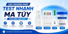 Các Phương Pháp Test Nhanh Ma Túy Phổ Biến Hiện Nay