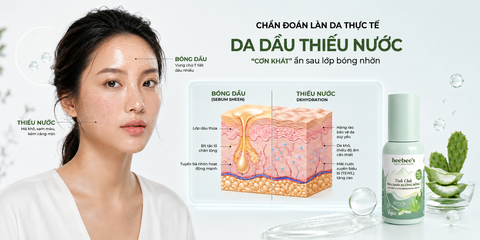 Da Dầu Thiếu Nước: “Cơn Khát” Khiến Da Xỉn Màu, Kém Mịn Và Dễ Thâm Mụn