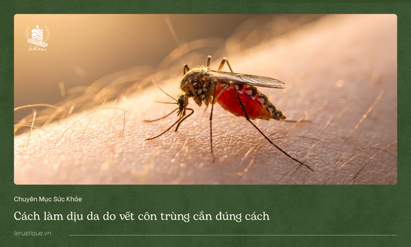 Cách làm dịu da do vết côn trùng cắn đúng cách