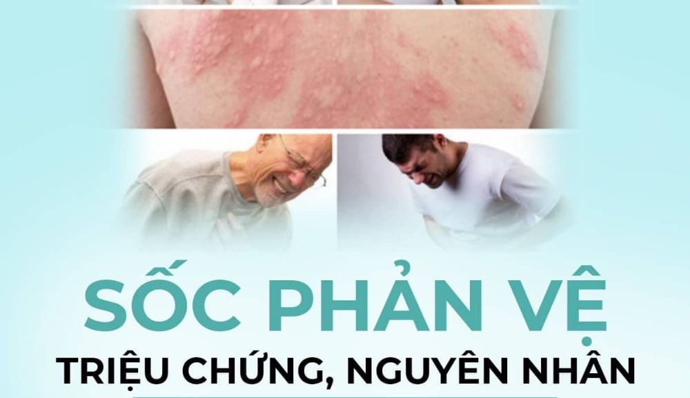 Biến chứng sau sốc phản vệ, Những nguy cơ và cách xử trí
