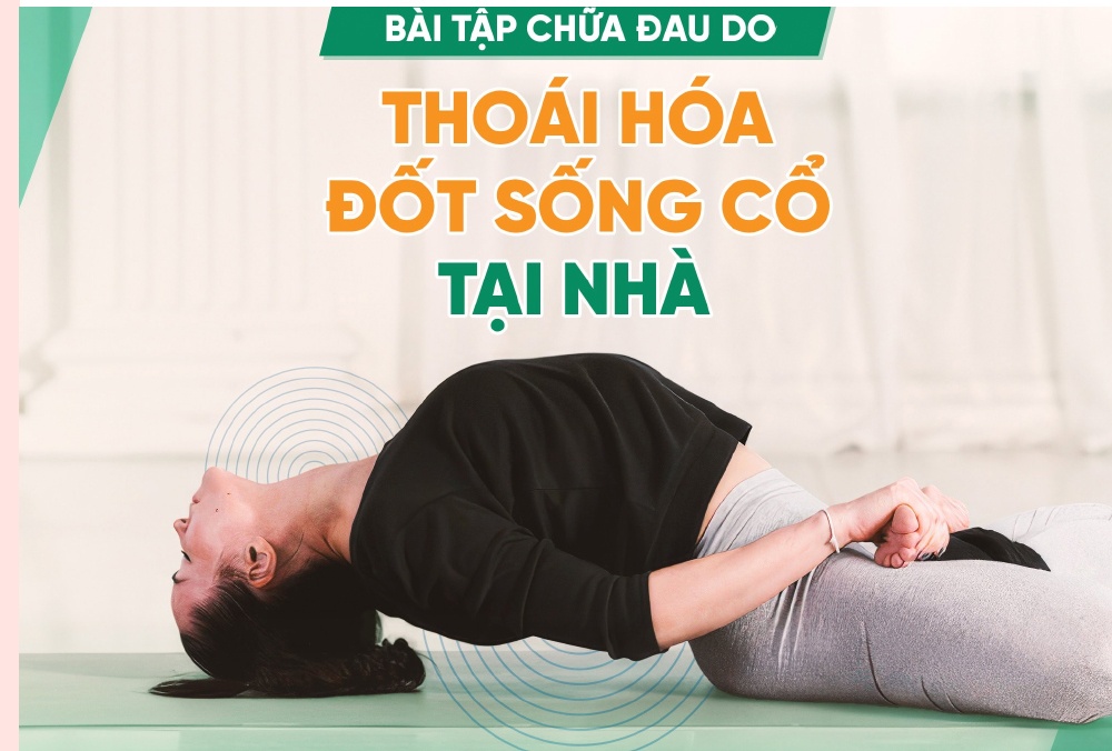 Các bài tập chữa thoát vị đĩa đệm đốt sống cổ hiệu quả