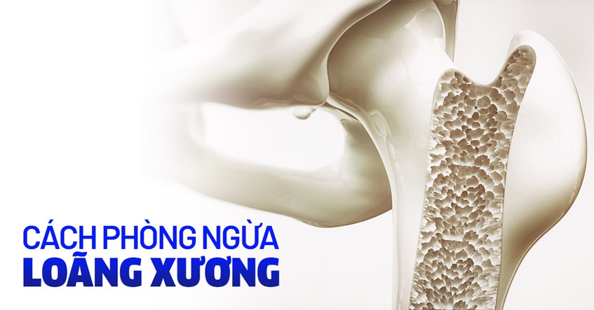 Các biện pháp phòng tránh bệnh loãng xương sớm hiệu quả