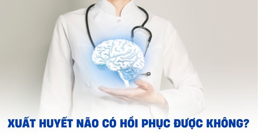 Xuất huyết não có thể hồi phục không? Thời gian và các yếu tố quyết định quá trình phục hồi