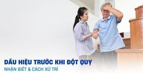 Đột quỵ đến bất ngờ - Nhận biết sớm để cứu sống kịp thời