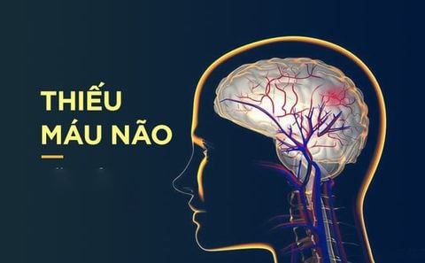 Những phương pháp hỗ trợ tuần hoàn máu não khỏe mạnh và bền vững