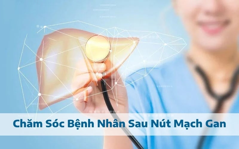 Quy trình chăm sóc bệnh nhân sau nút mạch gan để giảm biến chứng