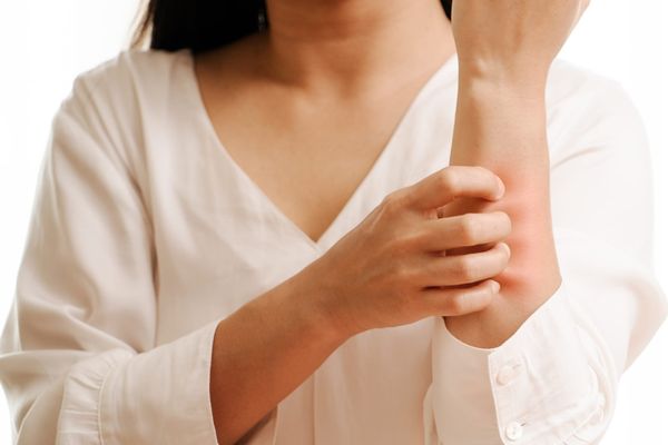 Cảnh báo da mùa hè: Cẩn thận với thực phẩm và thuốc nhạy cảm ánh sáng có thể làm giảm hiệu quả chống nắng