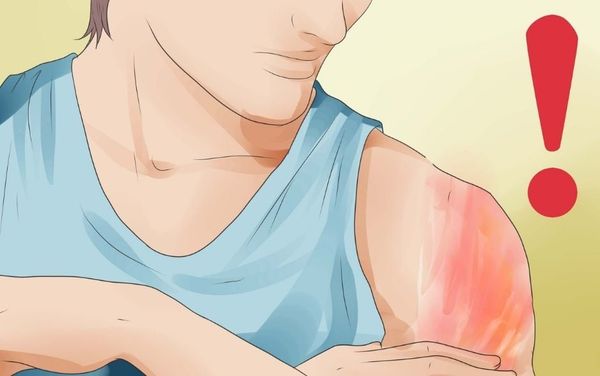 Vùng da nam giới bị hằn đỏ