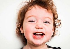 SÂU RĂNG Ở TRẺ EM