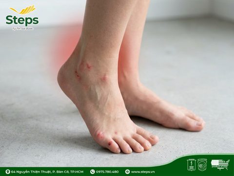 Đau cổ chân khi đứng lâu: Do thói quen hay do giày dép?