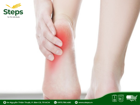 Vì sao sáng ngủ dậy hay bị đau gót chân?