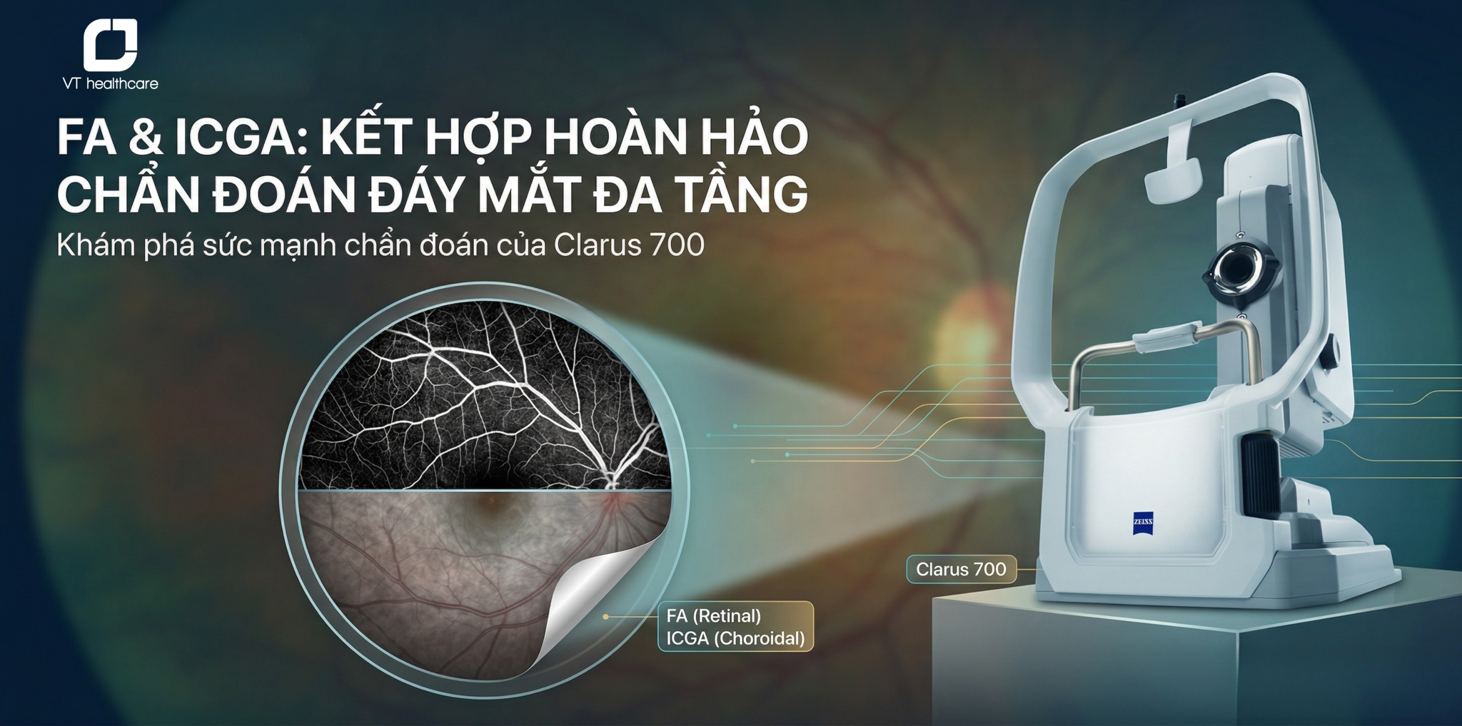 FA và ICGA Trong Chụp Huỳnh Quang Đáy Mắt: So Sánh Chi Tiết và Giá Trị Kết Hợp