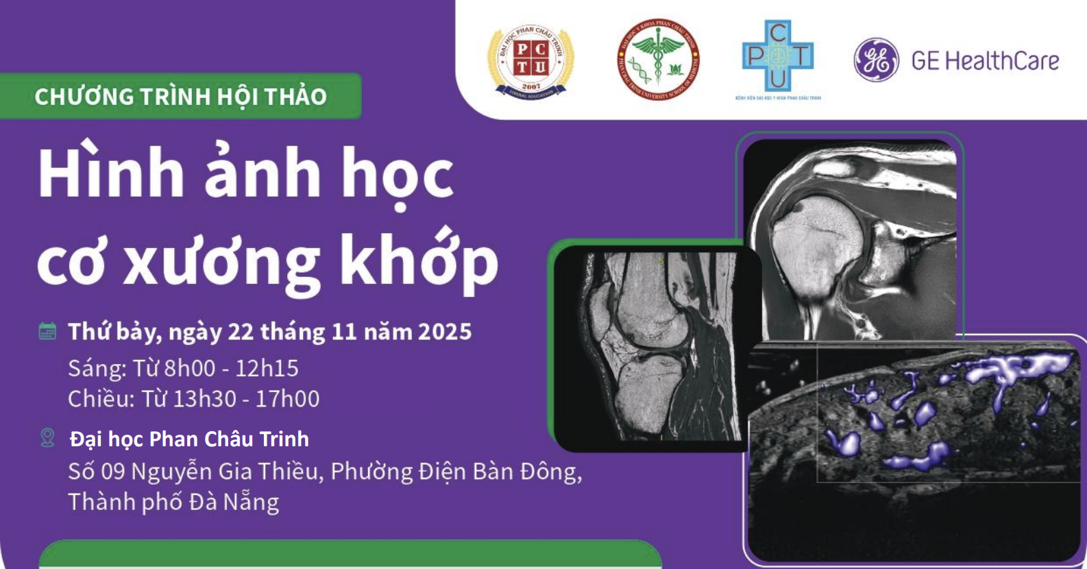 Hội thảo chuyên đề: Chẩn đoán Hình ảnh MRI Khớp vai - Khớp gối & Siêu âm Cơ Xương Khớp