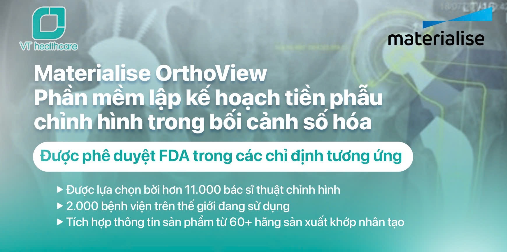 Materialise OrthoView - Phần mềm lập kế hoạch tiền phẫu chỉnh hình trong bối cảnh số hóa