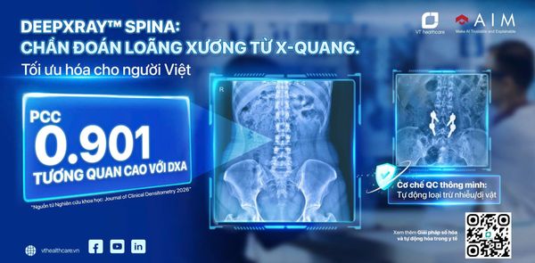 DeepXray™ Spina: Giải pháp AI biến X-quang FLS-X thành công cụ chẩn đoán loãng xương với độ đặc hiệu tuyệt đối