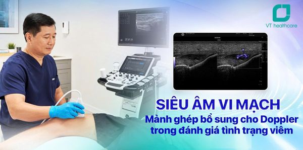 Siêu âm vi mạch: Bước tiến mới trong khảo sát cơ xương khớp