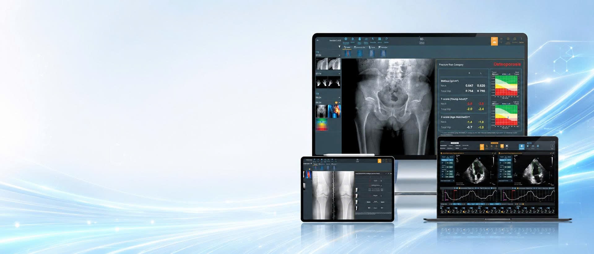 AIM - Giải pháp chỉnh hình & tim mạch của AI
