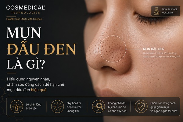 Mụn đầu đen là gì? Vì sao chúng xuất hiện và có thể phòng ngừa như thế nào?