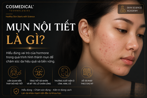Mụn nội tiết là gì? Dấu hiệu nhận biết và cách chăm sóc theo khoa học
