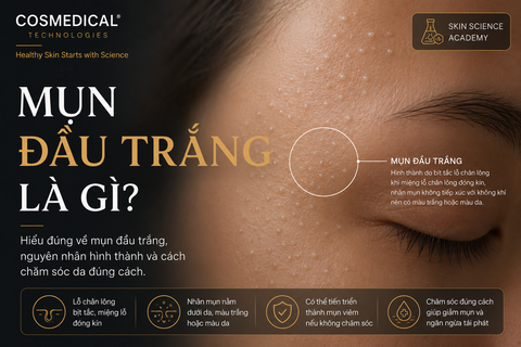 Mụn đầu trắng là gì? Nguyên nhân hình thành và cách chăm sóc đúng