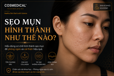 Sẹo mụn hình thành như thế nào? Hiểu đúng để phòng ngừa và cải thiện