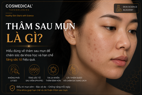 Thâm sau mụn là gì? Vì sao da bị thâm và làm sao để cải thiện?