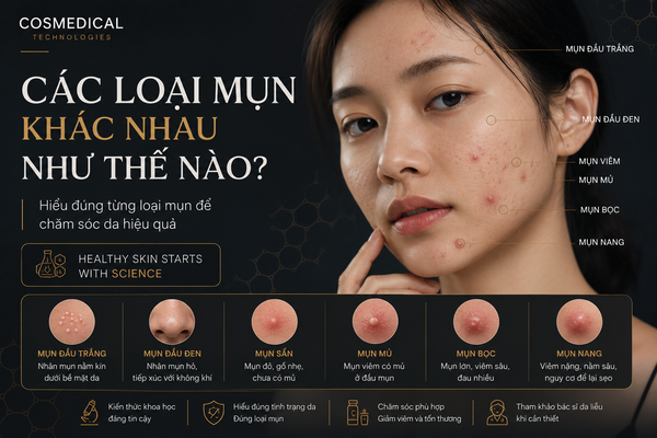 Các loại mụn khác nhau như thế nào?