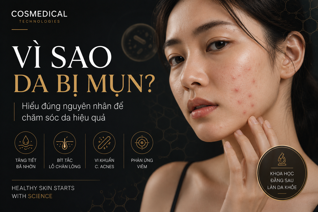 Vì sao da bị mụn? Hiểu đúng nguyên nhân để chăm sóc da hiệu quả