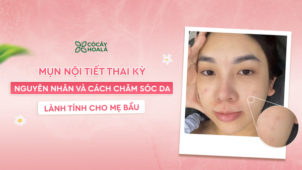 Mụn nội tiết thai kỳ: Nguyên nhân và cách chăm sóc da lành tính cho mẹ bầu