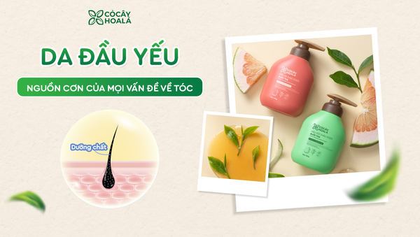 Da đầu yếu – Nguồn cơn của mọi vấn đề về tóc: Bạn đã chăm sóc 