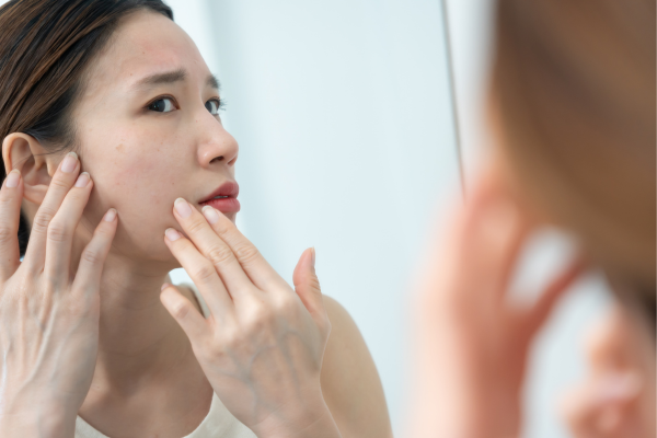 Lỗ Chân Lông To Có Thật Sự “Thu Nhỏ” Được Không?