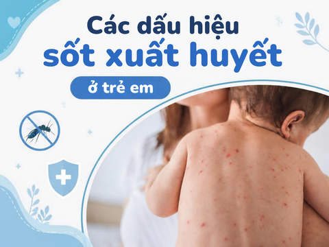 Các dấu hiệu sốt xuất huyết ở trẻ em