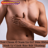 Trái Chàm Ở Nam Là Gì? Dấu Hiệu Sinh Lý Cảnh Báo Bất Thường