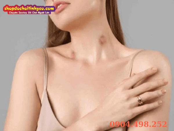 Các bước phục hồi da và xóa mờ dấu hickey nhanh