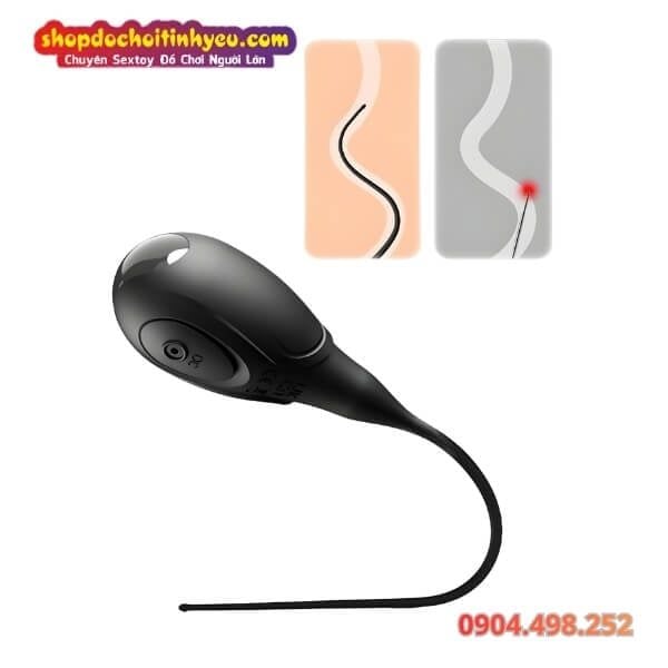 Que Rung Thông Niệu Đạo Điều Khiển Qua Ứng Dụng Điện Thoại