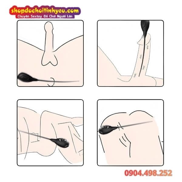 Que Rung Thông Niệu Đạo Điều Khiển Qua Ứng Dụng Điện Thoại