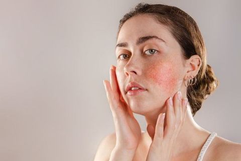 Da nhạy cảm với treatment – bí kíp phục hồi nhanh