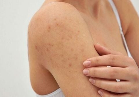 Chăm sóc da body sau sinh – bí quyết để mẹ trẻ tự tin hơn mỗi ngày