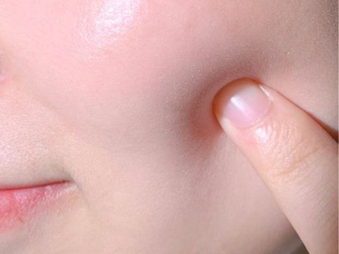 Bí quyết da căng mịn trước thềm hẹn hò hoặc du lịch