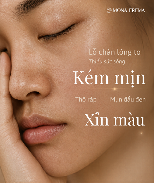 CHĂM DA RẤT KỸ NHƯNG VẪN KHÔNG MỊN MÀNG – VÌ SAO?