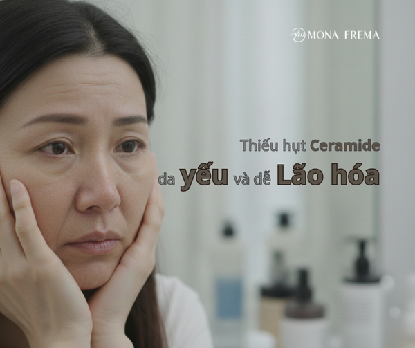 THIẾU HỤT CERAMIDE - LÝ DO KHIẾN DA YẾU VÀ DỄ LÃO HÓA